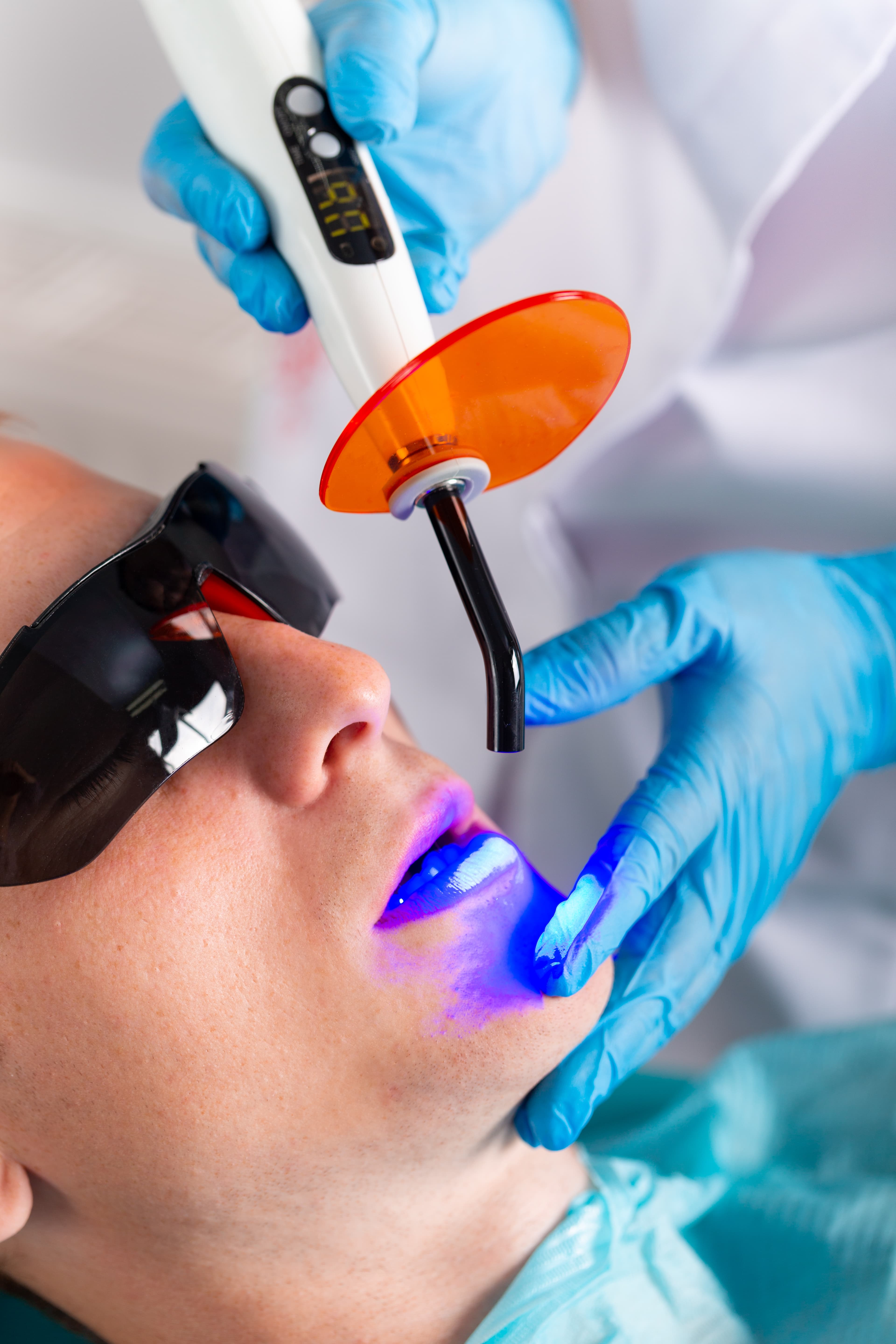 Smile Makeover: Türkiye’de Diş Estetiği ile Yeni Bir Başlangıç